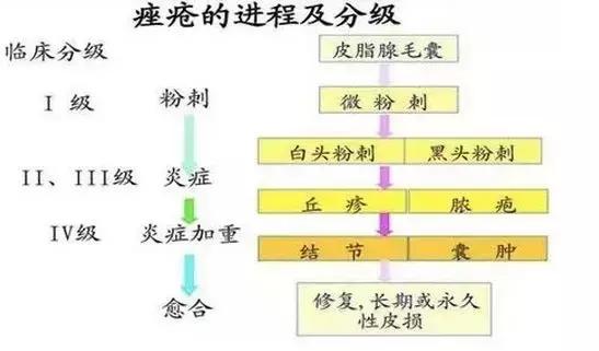 反复长痘痘，“凶手”究竟是谁？